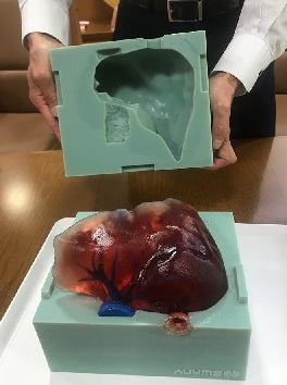 3Dプリント樹脂型「デジタルモールド」で成形した肝臓のモデル。植物由来の材料でできており、型と3Dプリンタで造形された血管を用いて繰り返し作製することができる。