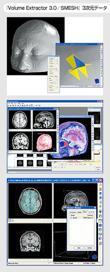 「Volume Extractor3.0/SMESH」3次元データ